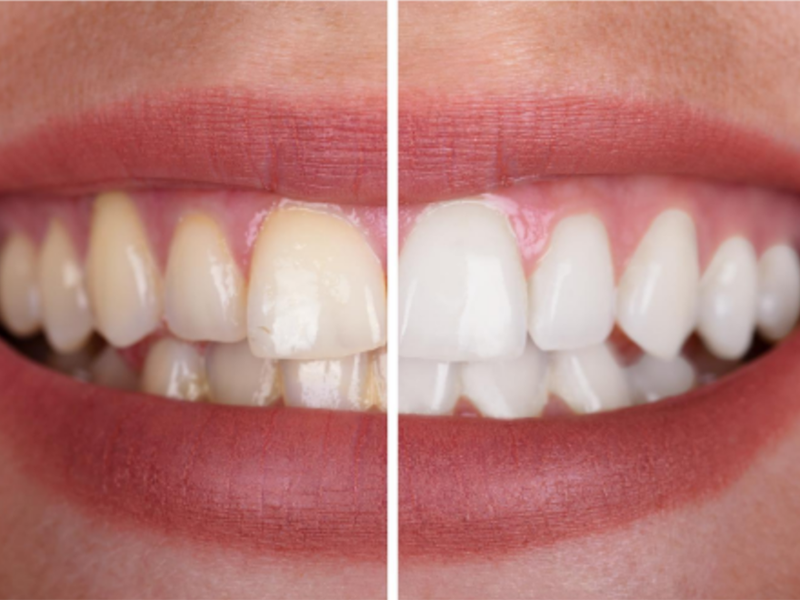 odontologia preventiva y restauradora