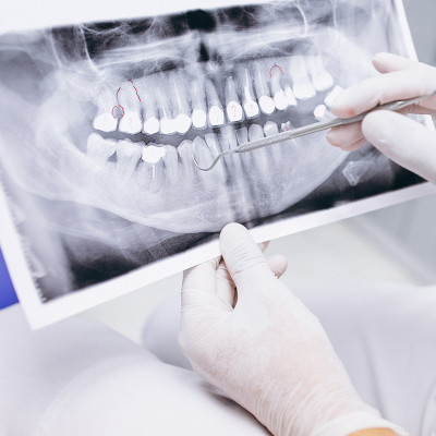 Odontología preventiva y restauradora